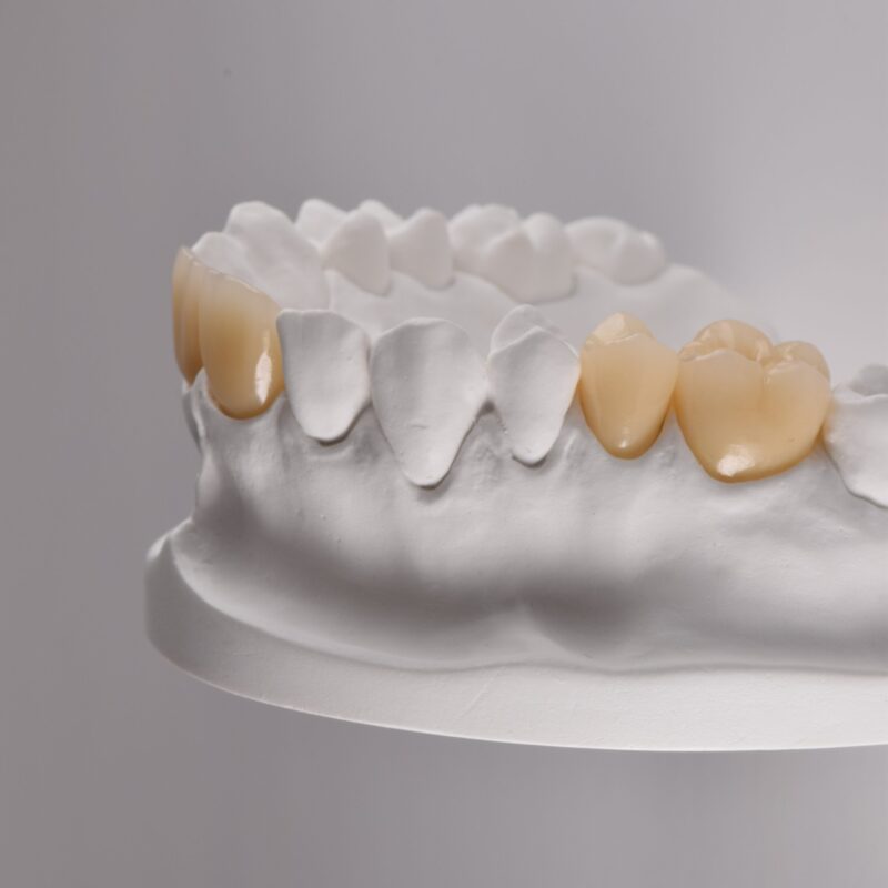 Best Value Ceramics Your Affordable Dental Laboratory Since 1989